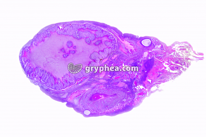 Ovaire humain avec corps jaune entier x2 - gryphea.com